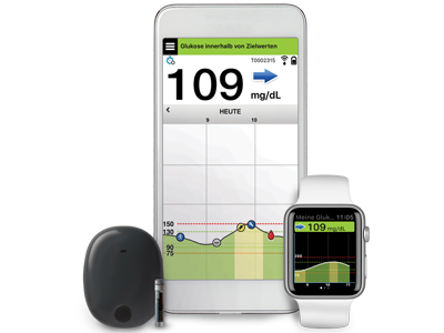 Eversense CGM