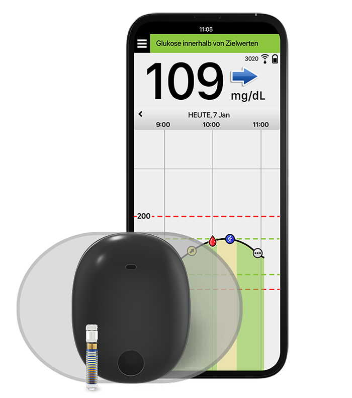 Eversense CGM