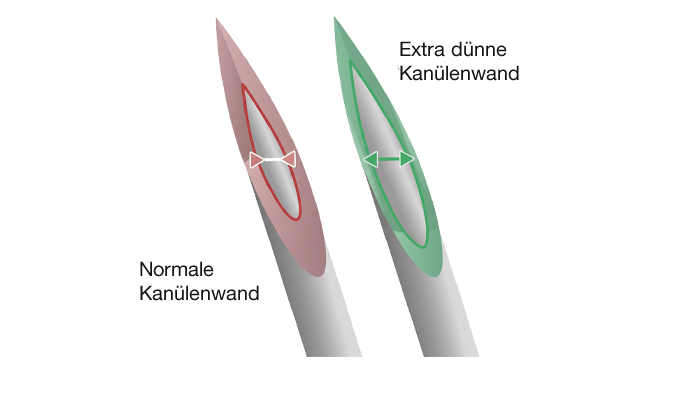 Grafik zur Veranschaulichung dünner Nadelwände